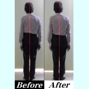 カイロプラクティックの「肩凝り」を改善する治療法
