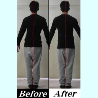 「背中の痛み、背骨の痛み」の治す方法と浜松市のカイロプラクティック