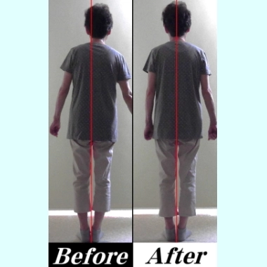 カイロプラクティックの「背中の痛み、背骨の痛み」を改善する治療法